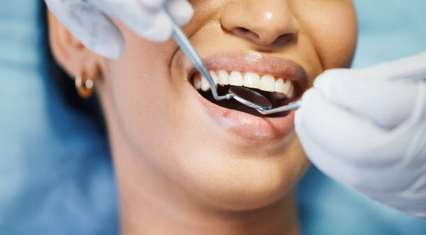 Best Emergency Treatment for Dental Infections or Abscesses in Tolono, IL