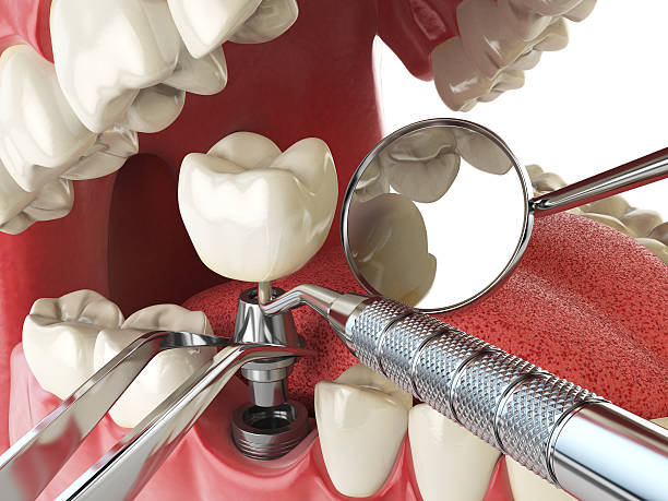 Best Emergency Gum Treatment in Tolono, IL