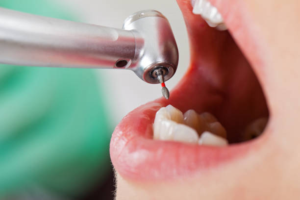 Best Cosmetic Emergency Dentistry in Tolono, IL